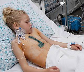 Kids still suffering in Ukraine because of Chernobyl reactor explosion.