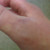 Still swollen but bruising lighter. Still swollen but bruising lighter.