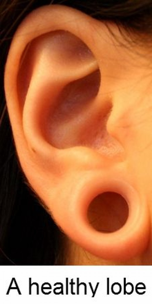 Ear Stretching know as gauging) hubpages