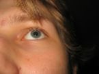 Singed eyebrows and hair.  mine was far worse than this.  Alas I didn't have a camera nearby at the time.