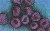 Bird flu viruses.      Credit:  electromicrovirus.uf