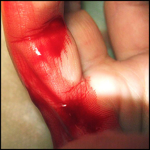 Glass can slice you badly.