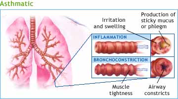 Notice how the lungs function when someone has asthma.