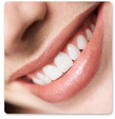 White Teeth 