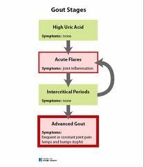 Gout Stages