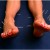 Acupuncture of blisters? Acupuncture of blisters?