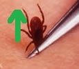 How to remove a tick.