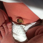 The umbilical cord is thrown away, if not collected and stored. 