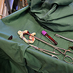 The procedure is extremely simple and non-intrusive.  