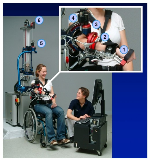 Advanced therapies like robotic training assisted by a bot helps stroke patients recover much faster.