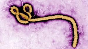 an image of the Ebola virus
