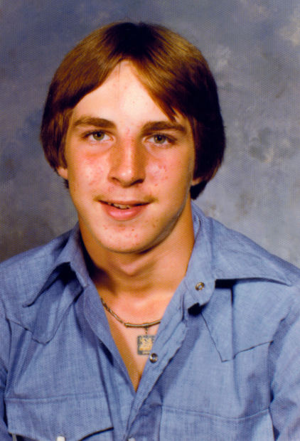 A young man suffering from acne