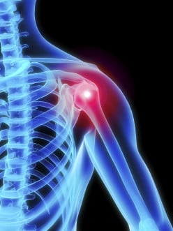 Frozen Shoulder - Physiotherapy Treatment #1