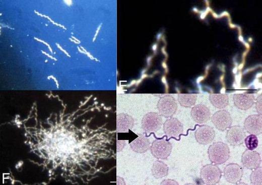 Clockwise from top left: B. burdorferi. By CDC [Public domain], via Wikimedia Commons; 'Typical' B. burgdorferi spirochete (E) and 'Colony' form (F). By J.Miklossy, S.Kasas, A. Zurn, S, McCall, S.Yu and P. McGeer; B. thieleri. By Alan Walker.