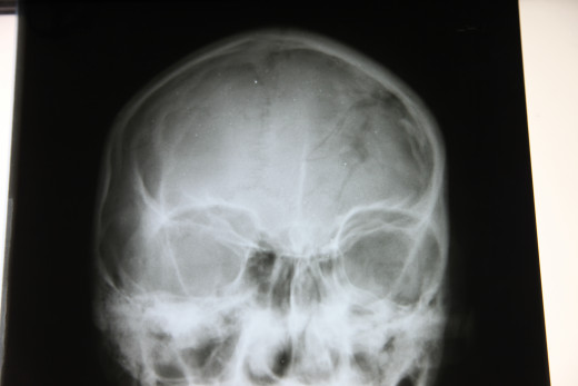 This is not my skull in the x-ray