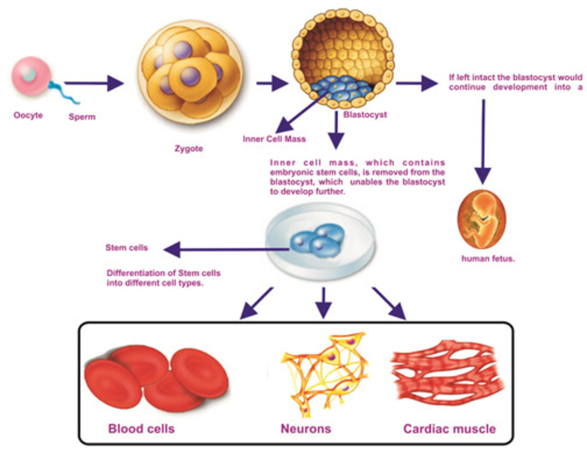 Ethical Problems of Human Embryonic Stem Cell use in