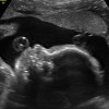 KgCt profile image