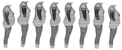 8 Women with a BMI of 30