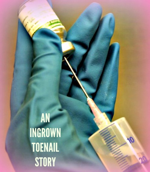 My Ingrown Toenail Adventure My Ingrown Toenail Adventure