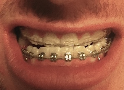 A bit of progress.