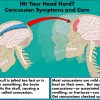 Hit Your Head Hard? Concussion Symptoms and Care