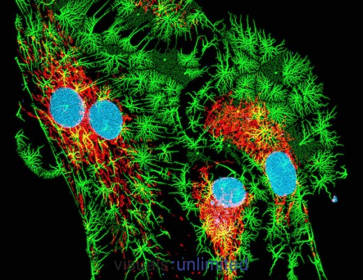 Bovine pulmonary artery epithelium cells colored by fluorescent staining