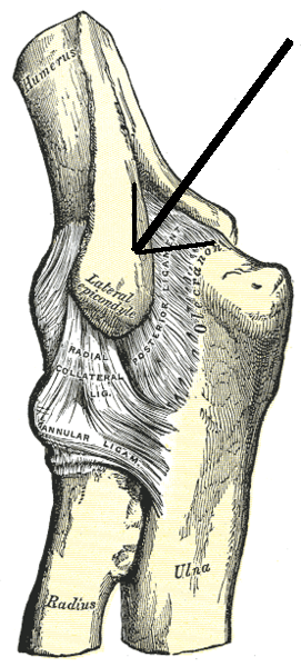 Lateral Epicondyle as indicated by the arrow
