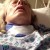 Right after surgery Right after surgery