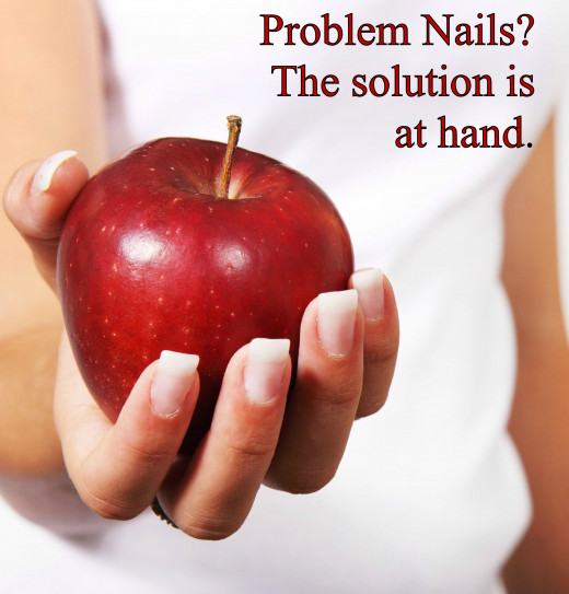 Problem nails