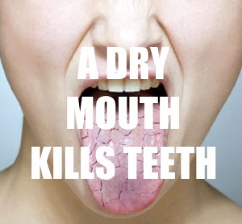 Why Is My Mouth Always Dry? | HubPages