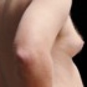 Lose-Man-Boobs profile image