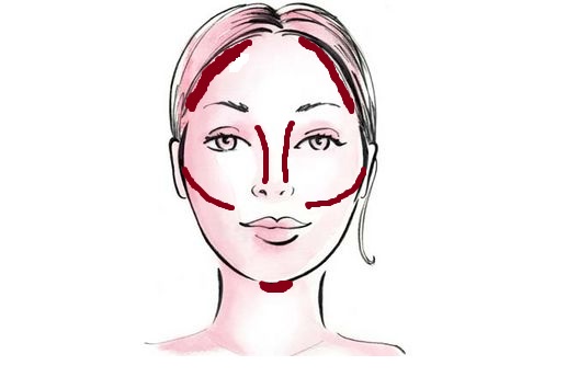 Temples, nose, under chin, hallow of cheeks