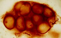 Ancient Fossil Bacteria about 850 million years old.