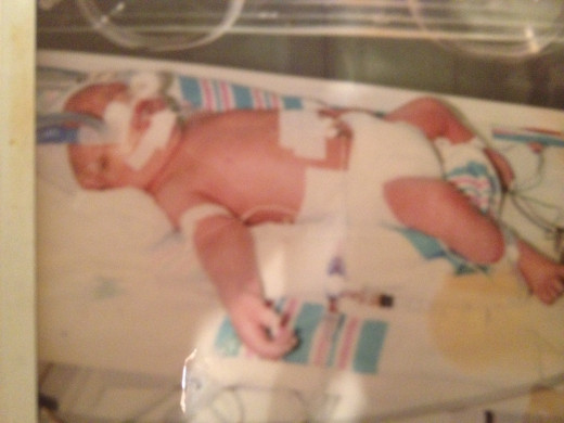 Alex just hours old at 32 weeks.  He had a central line and was intubated.