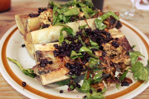 Bone marrow at Manitoba