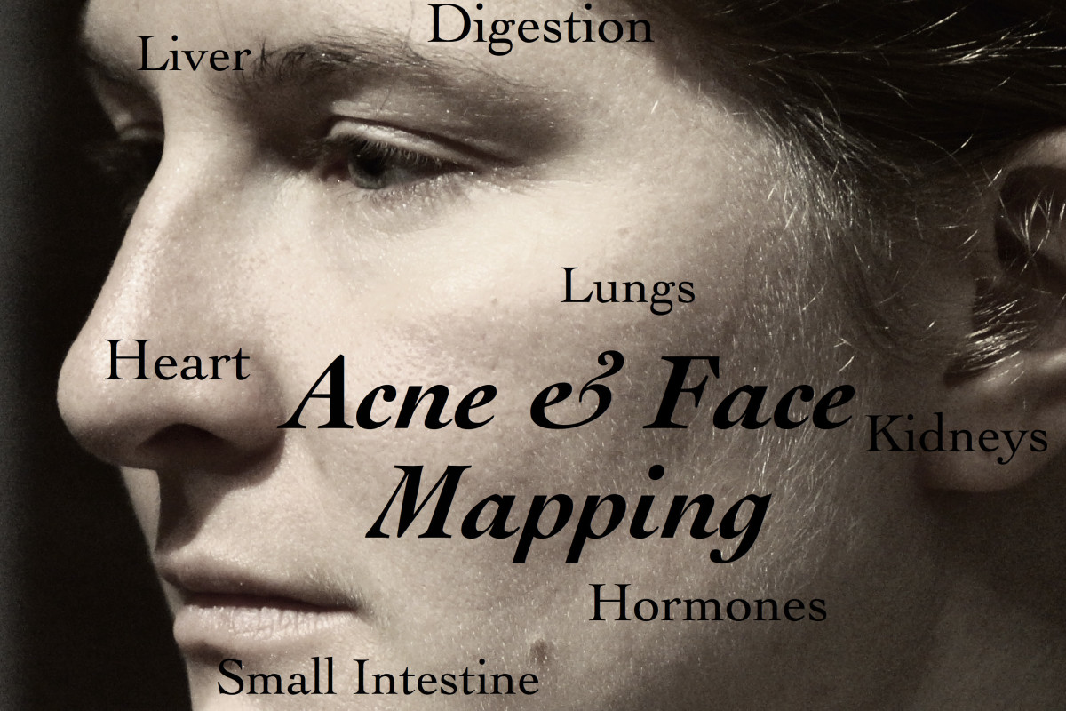 Reflexology Face Chart Acne