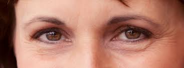 Wrinkled eyes - visible effect of aging