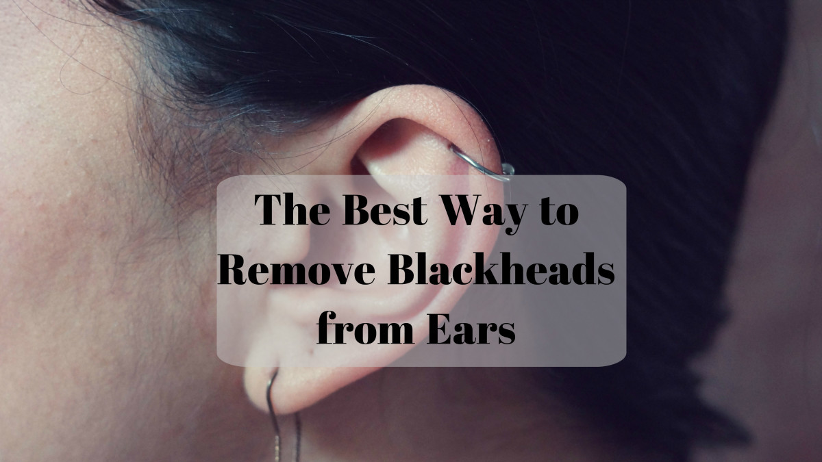 How to Get Rid of Blackheads in the Ears Bellatory