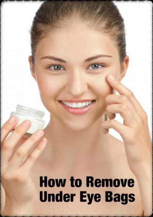 Under Eye Bags Treatments, Causes And Best Cream | hubpages