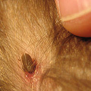 Deer tick embedded in a young child's head.