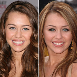 Miley Cyrus - Porcelain veneers can improve your smile