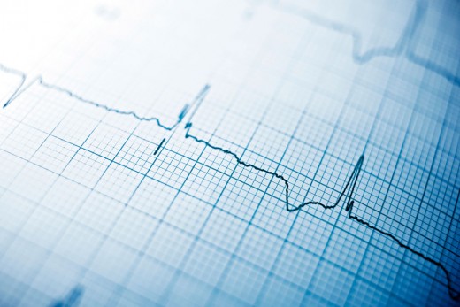 While targeted apps can be very helpful, they are not a replacement for the standard 12 lead ECG.
