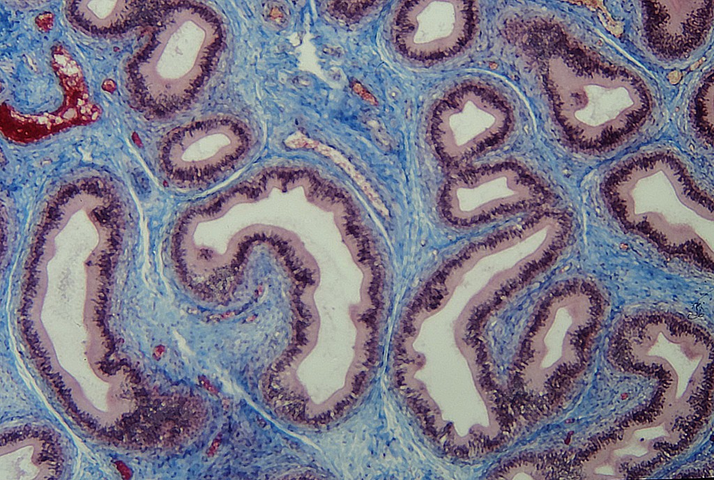 Definition Types Function Of Connective Tissue Hubpages