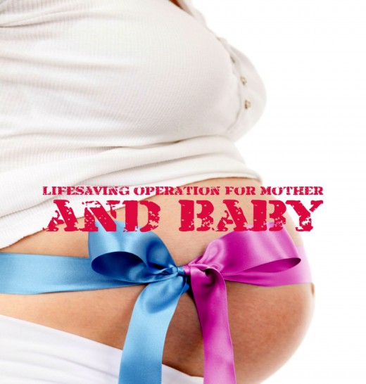 A Caesarian birth puts greater demands on your body and its recovery than if you had a vaginal delivery. 
