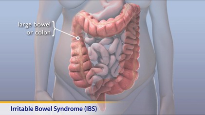 Diagram of large bowel and colon
