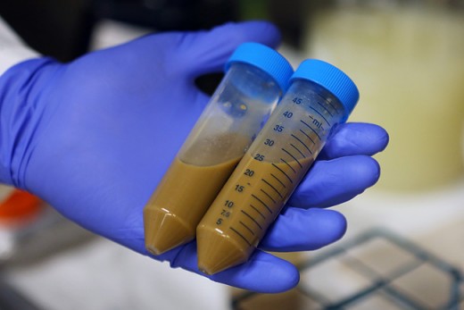 Vials containing "donated" fecal material