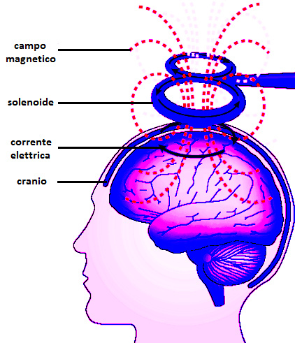 Transcranial Magnetic Stimulation. The photo shows how this work through the brain.