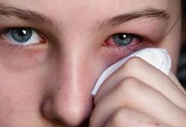 Eye Infection
