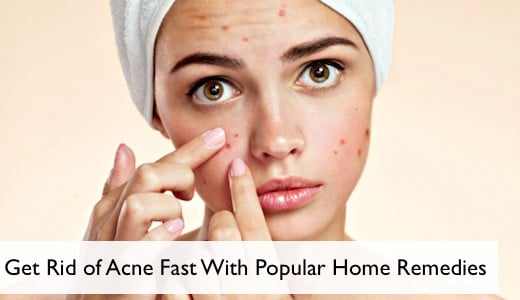 Acne is a popular skin disease. What causes it is unclear, but hormonal fluctuations seem to play a key role. It may get worse when infected by bacteria P. acne.