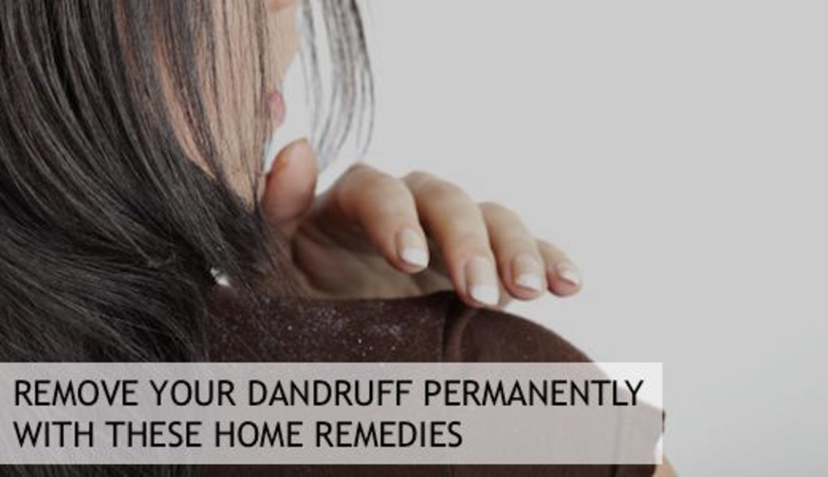 Homemade Tips To Remove Dandruff From Hair / Remove Your Dandruff Permanently With These Home Remedies ...